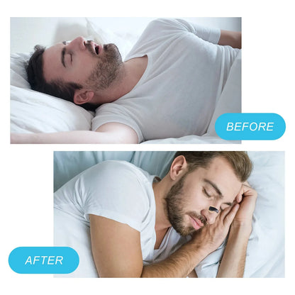 DORMYSA - Breathe Better Every Night